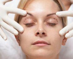 Quelle assurance souscrire pour une opération de chirurgie esthétique ?